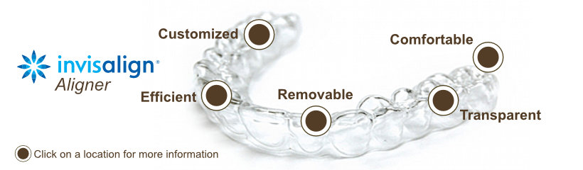 Invisalign Aligner